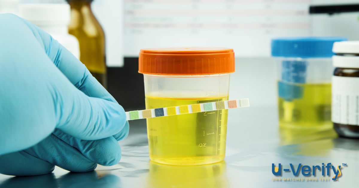 urine drug testing