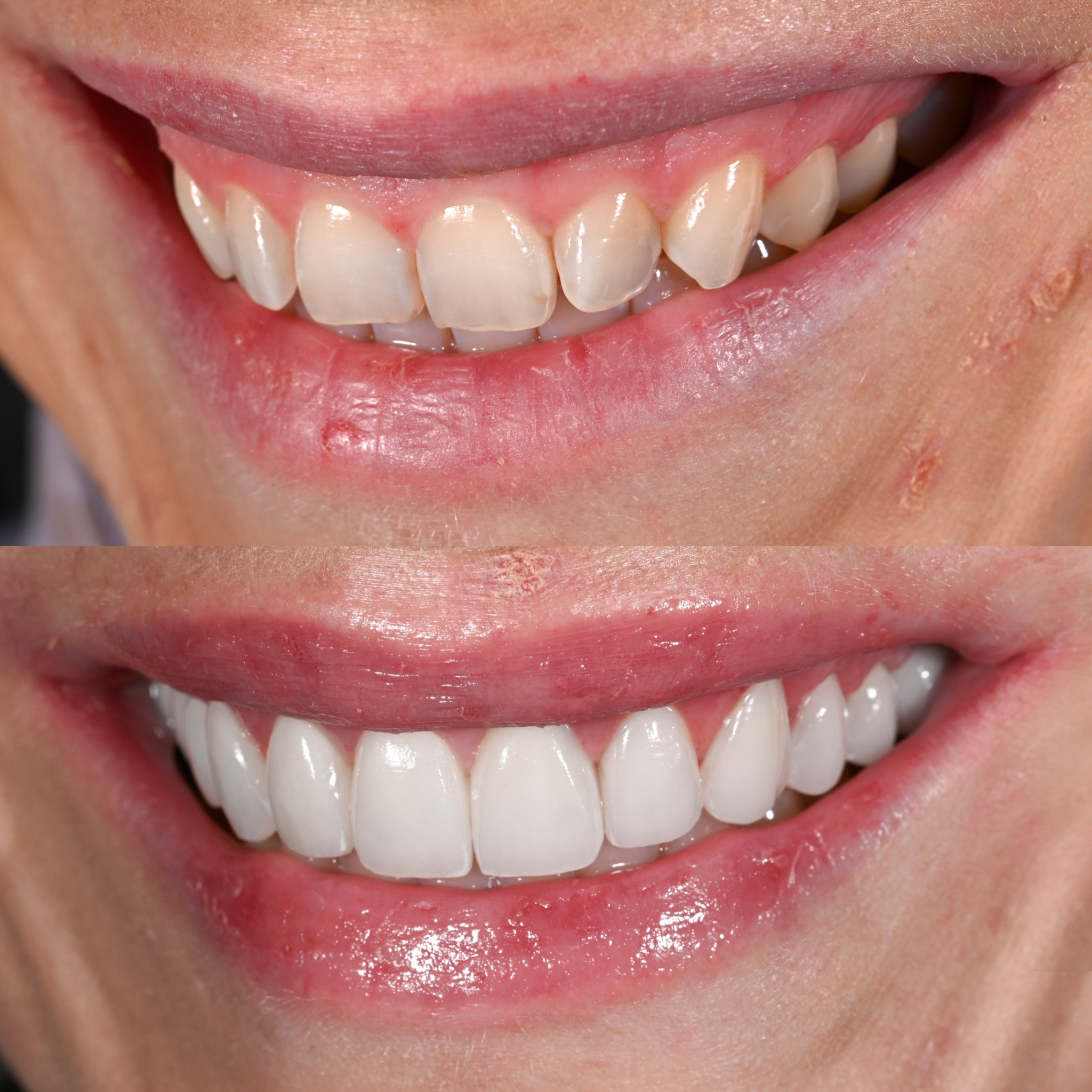teeth