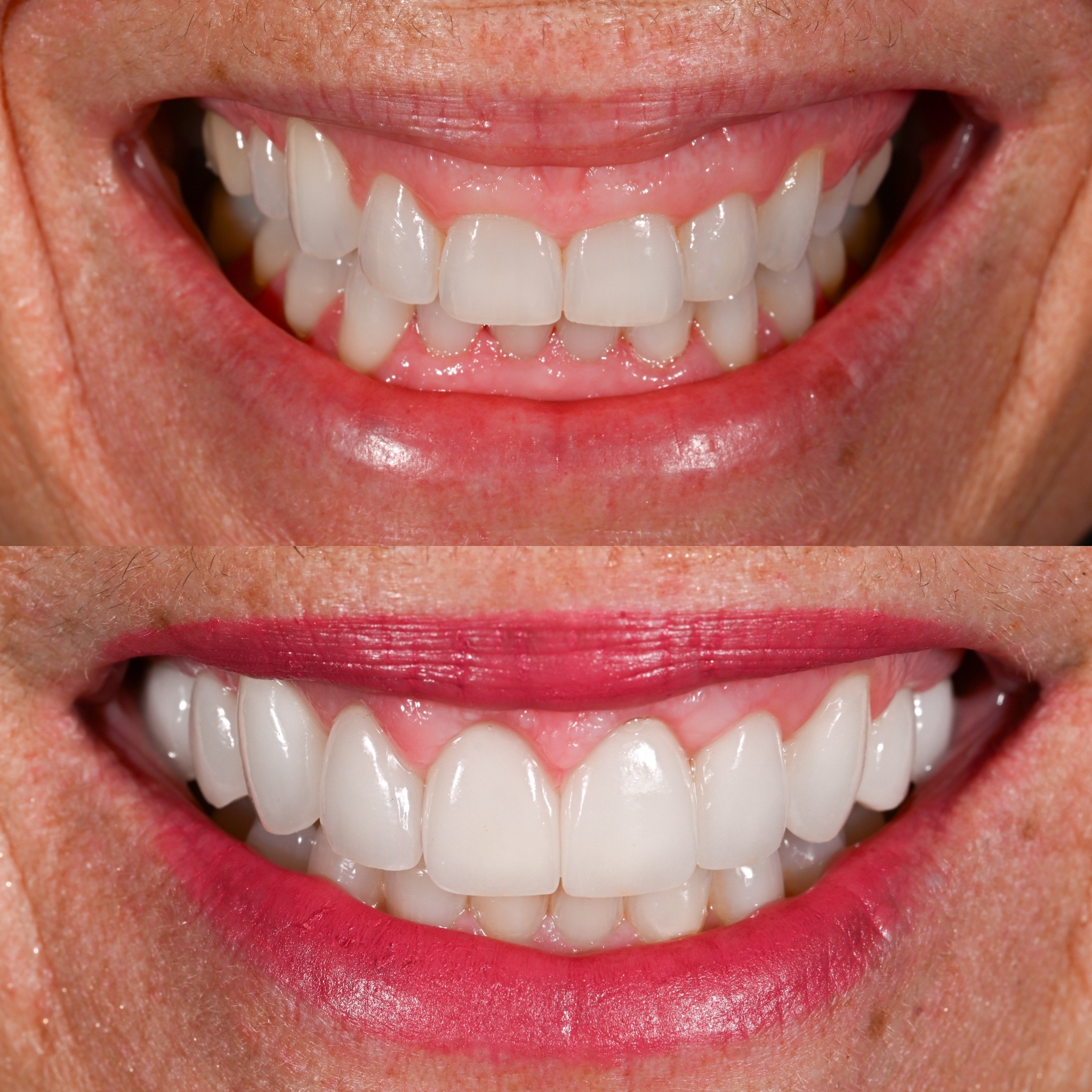 teeth