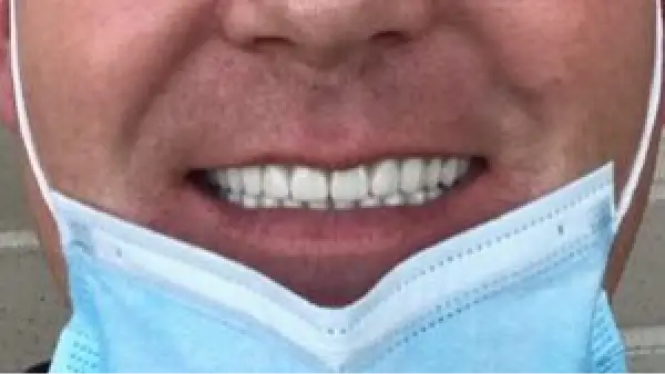 A close up of a person wearing a face mask.