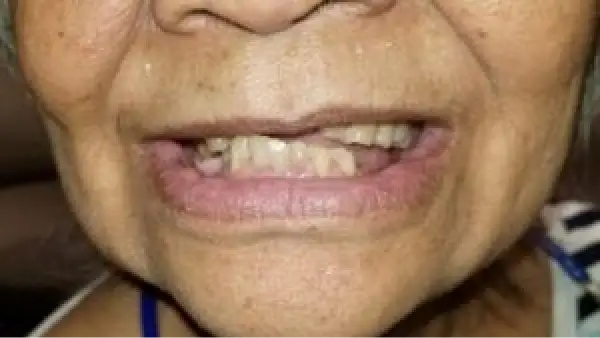 A close up of a woman's face with a missing tooth.