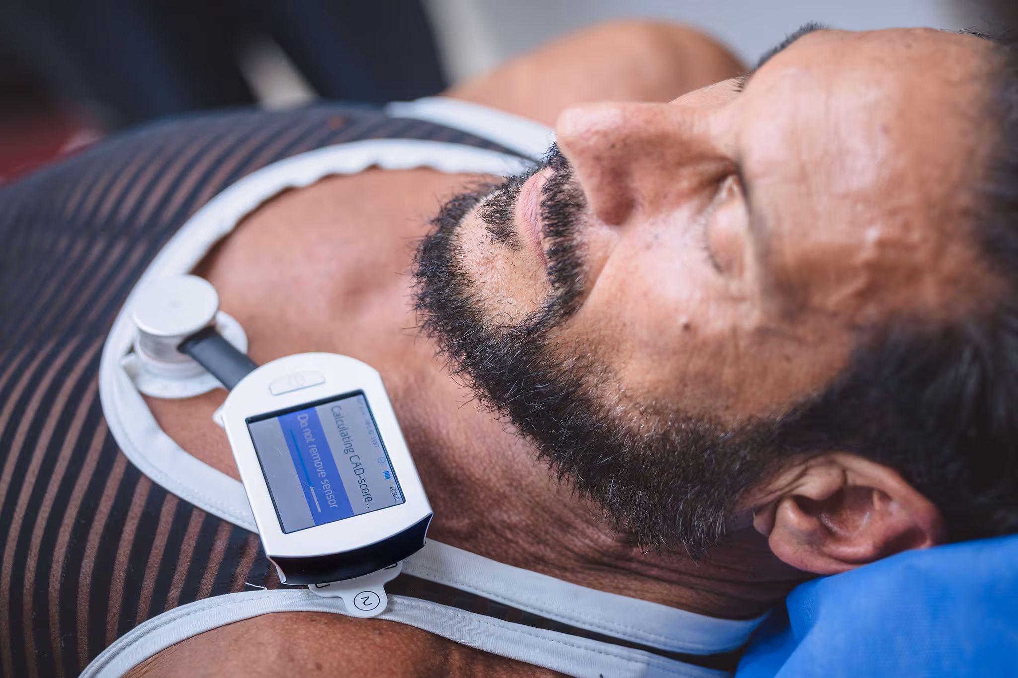 CADScor® — Redefining Coronary Artery Disease Detection
