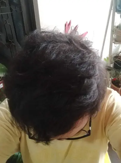 Resultado do Ricardo depois de 3 meses de tratamento