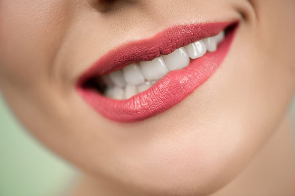 Dental Veneers in Istanbul: The Complete 2025 Guide for International Patients