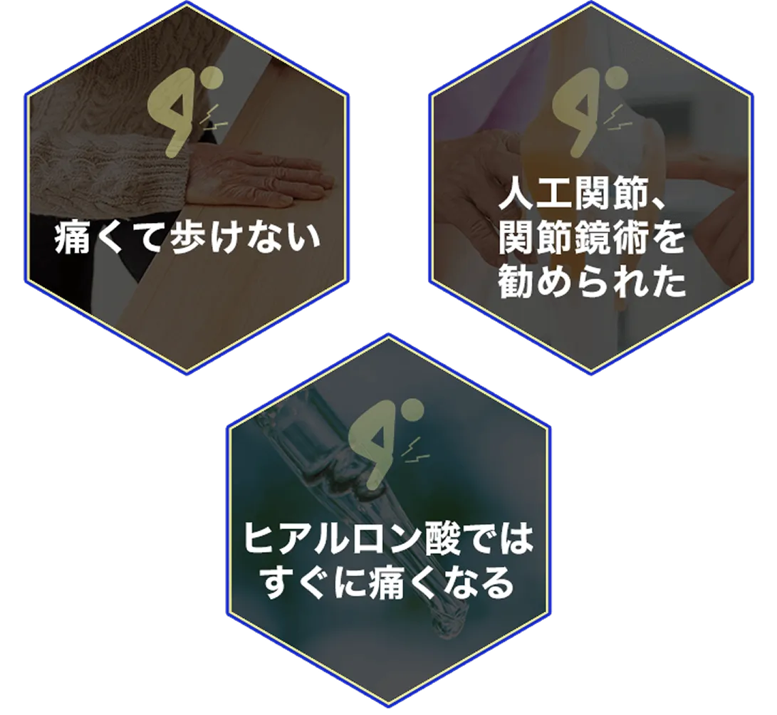 痛くて歩けない
人工関節、関節鏡術を勧められた
ヒアルロン酸ではすぐに痛くなる