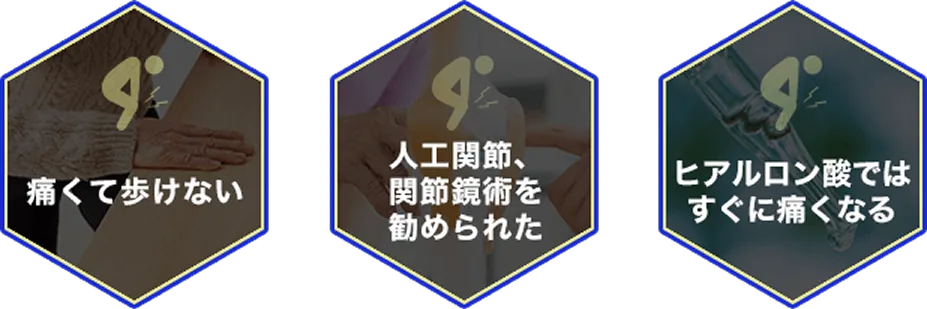 痛くて歩けない
人工関節、関節鏡術を勧められた
ヒアルロン酸ではすぐに痛くなる