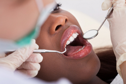 Teeth Cleaning
