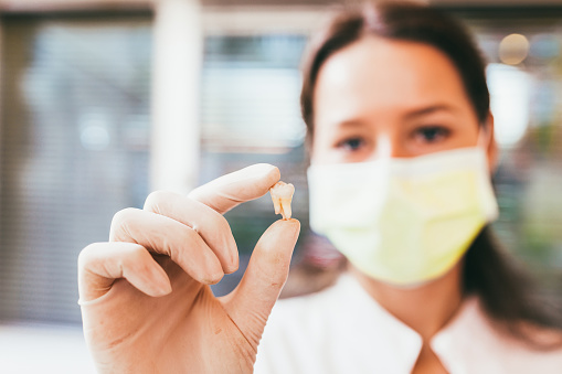 Tooth Extraction for Pain Management