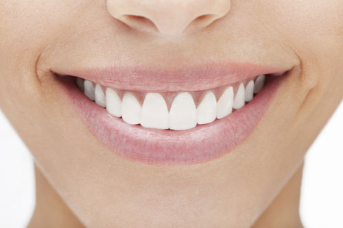 Teeth Veneers