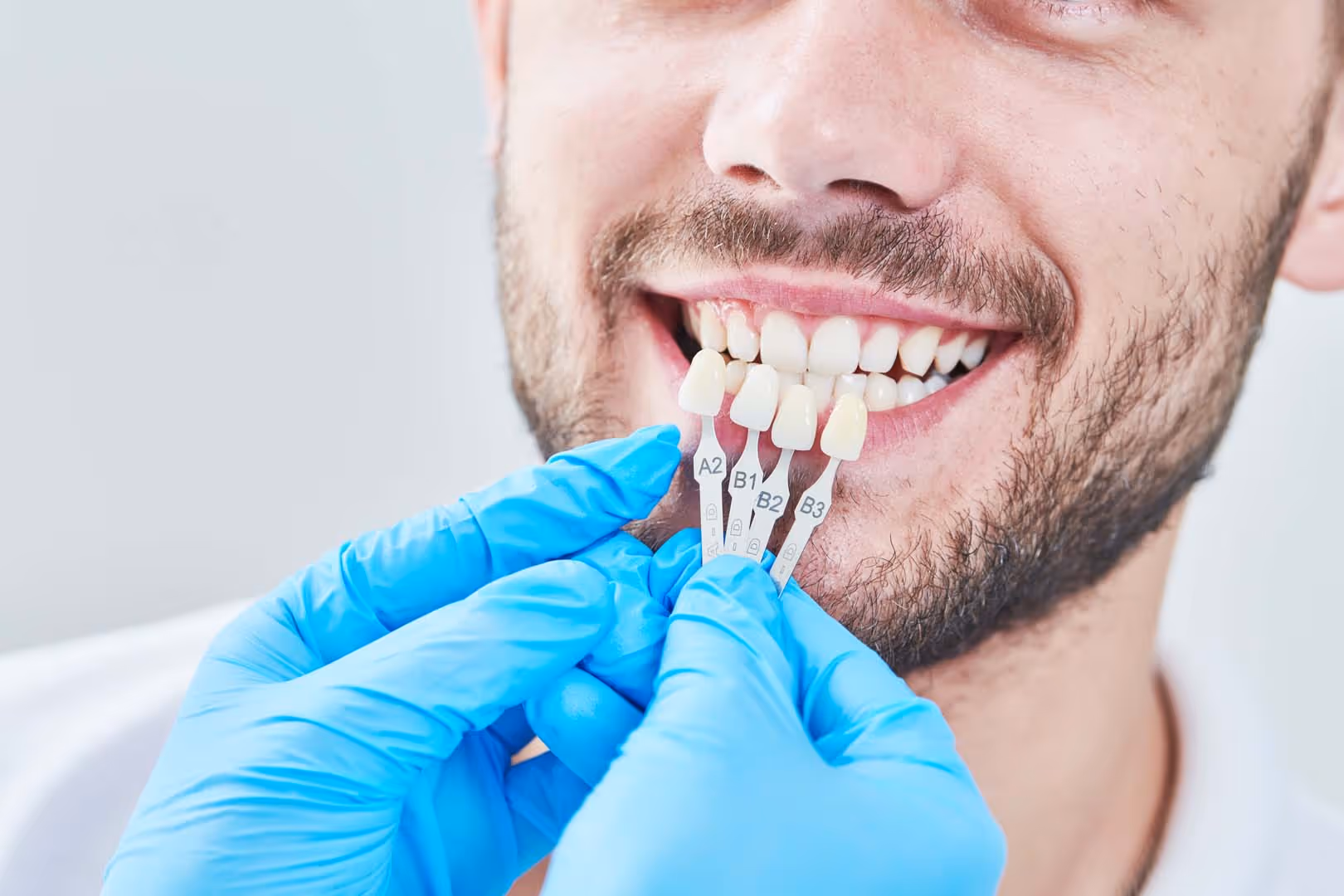 Porcelain Veneers in Orange Park, FL