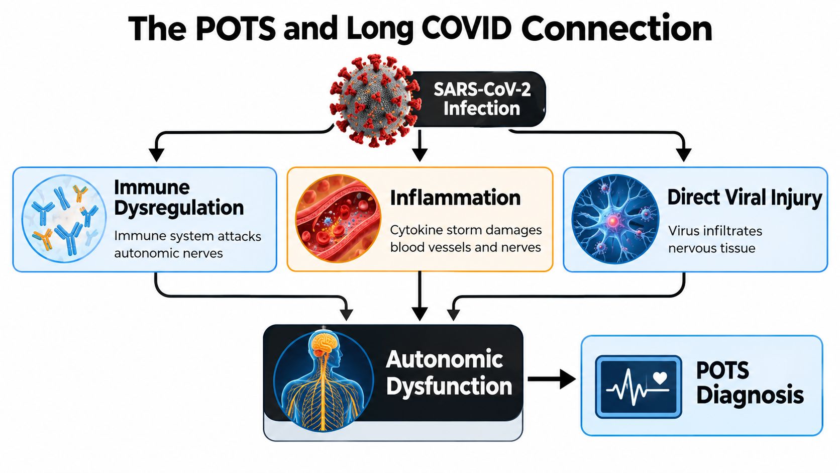 A diagram illustrating how SARS-CoV-2 infection causes autonomic dysfunction leading to a POTS diagnosis via multiple pathways.