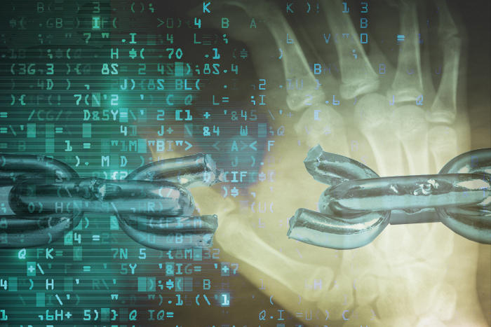Broken chain link overlaid on an X-ray image of a human hand with digital code symbols.