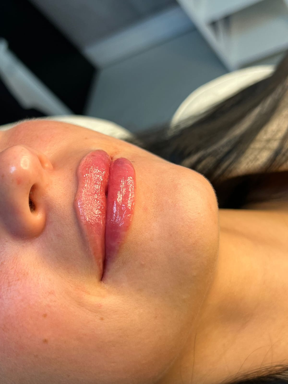 Russian Lips Ulm im Aesthetica Naturheilzentrum