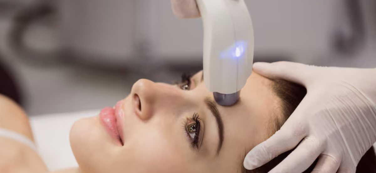 Lifting viso HIFU senza bisturi