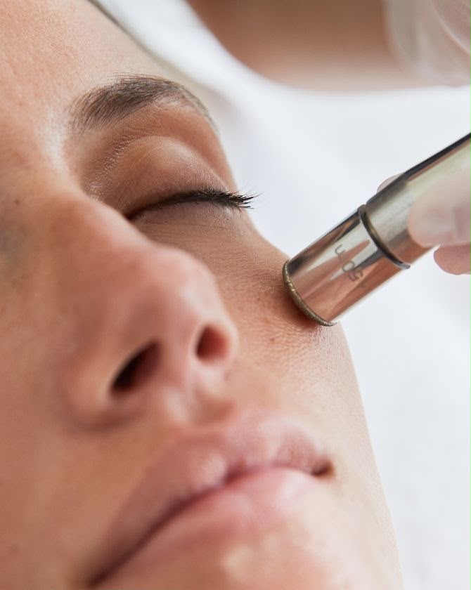 Microdermabraziune cu capat de diamant la SkinXpert