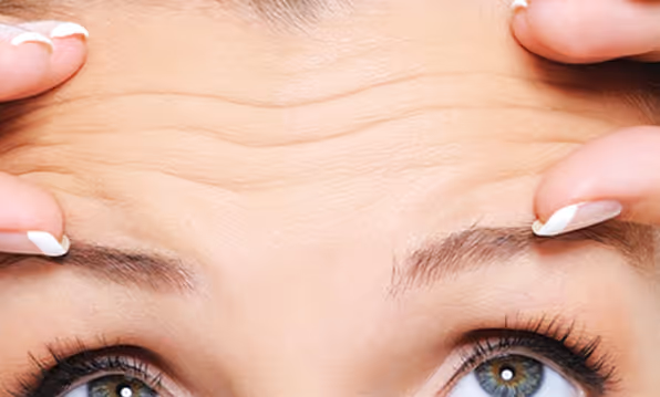 Sigurno i efikasno rješenje za bore lica – sve što trebate znati o botoksu