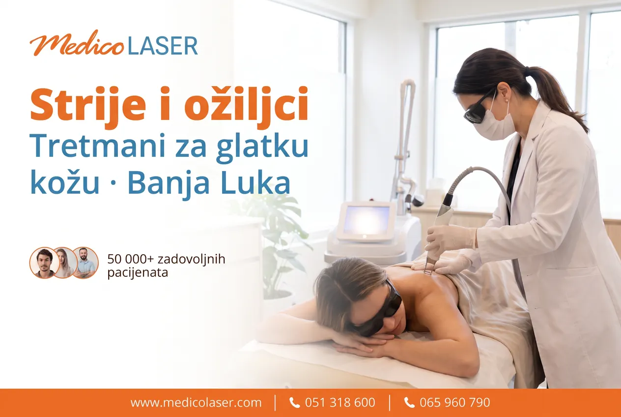 Strije i ožiljci