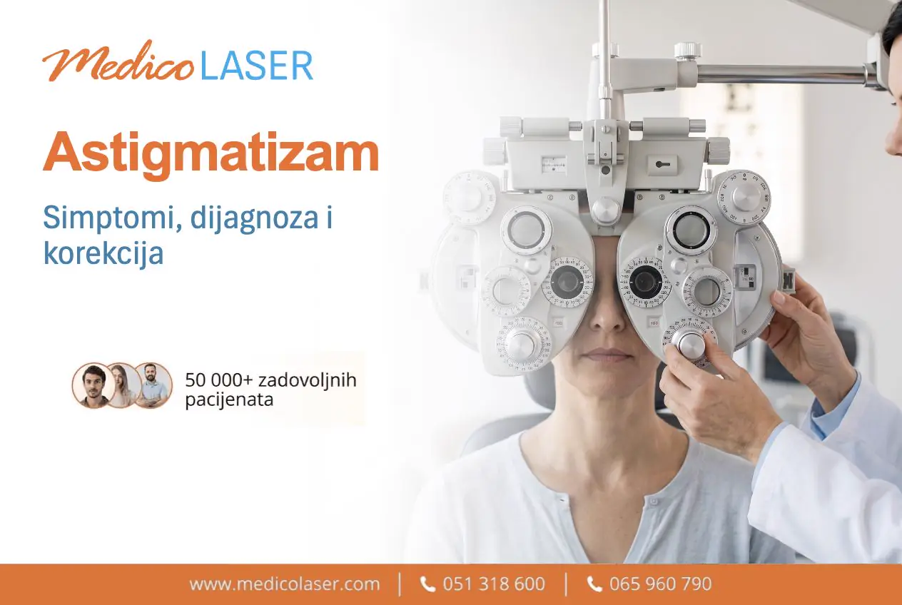 Astigmatizam
