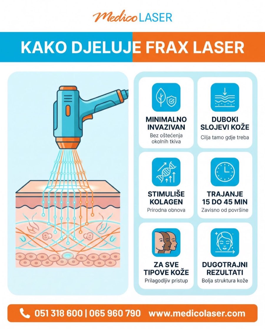Kako djeluje FRAX 1550 laser - infografika