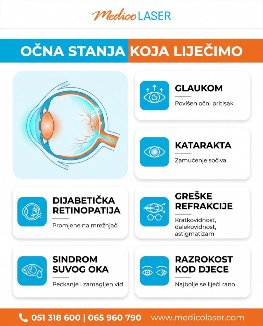 Očna stanja koja liječimo - infografika
