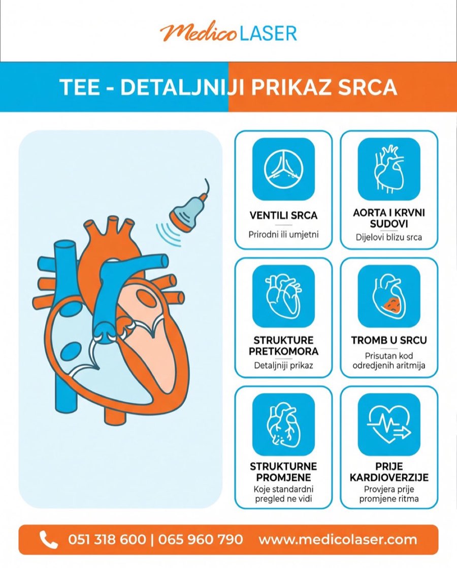 Šta TEE može detaljnije prikazati - infografika