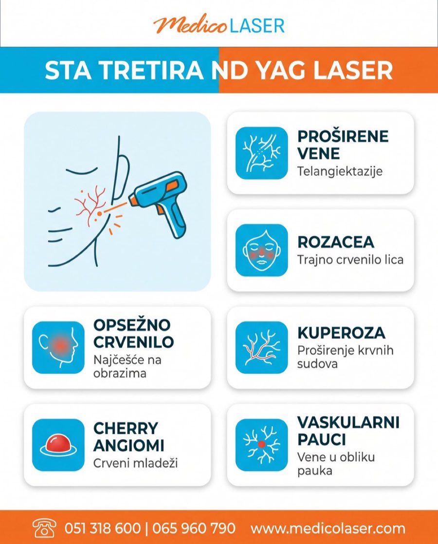 Sta tretira Nd YAG laser - infografika