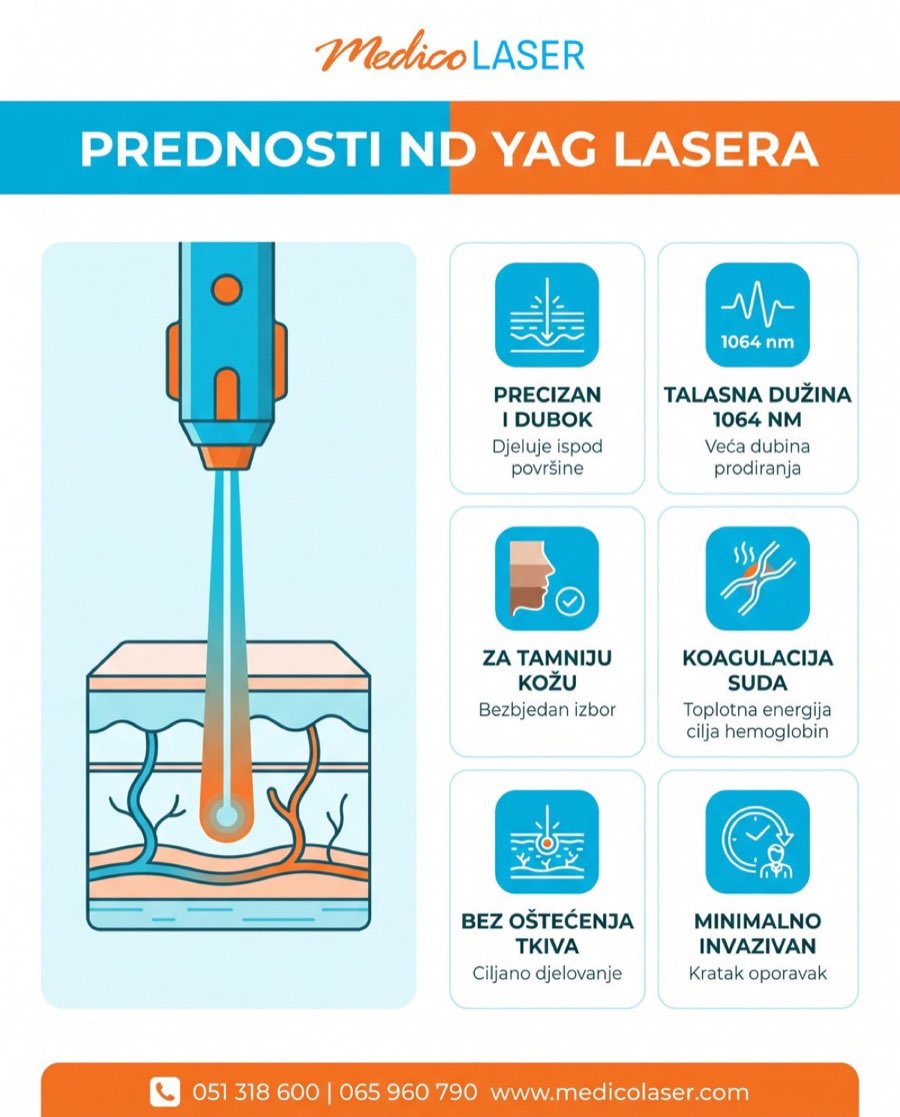 Prednosti Nd YAG lasera - infografika