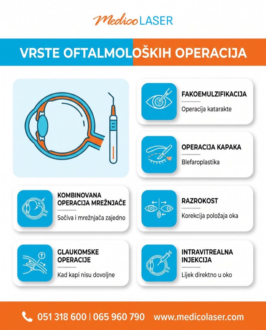 Vrste oftalmoloških operacija - infografika