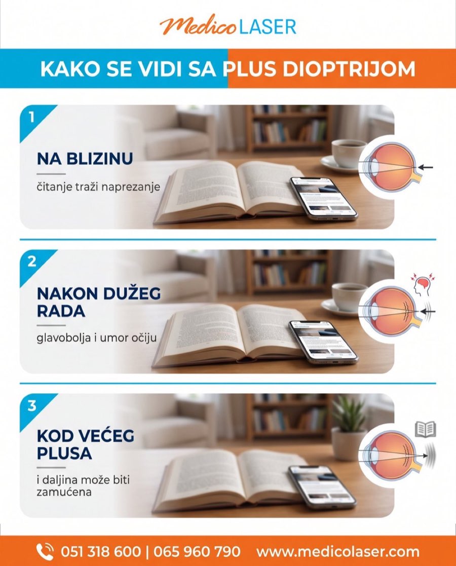 Kako se vidi plus dioptrija - infografika