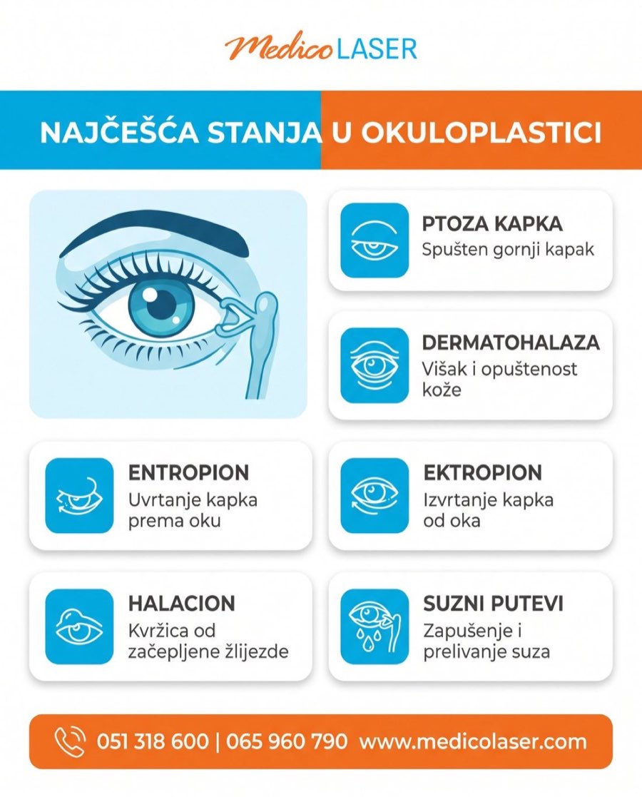 Najcesca stanja u okuloplastici - infografika