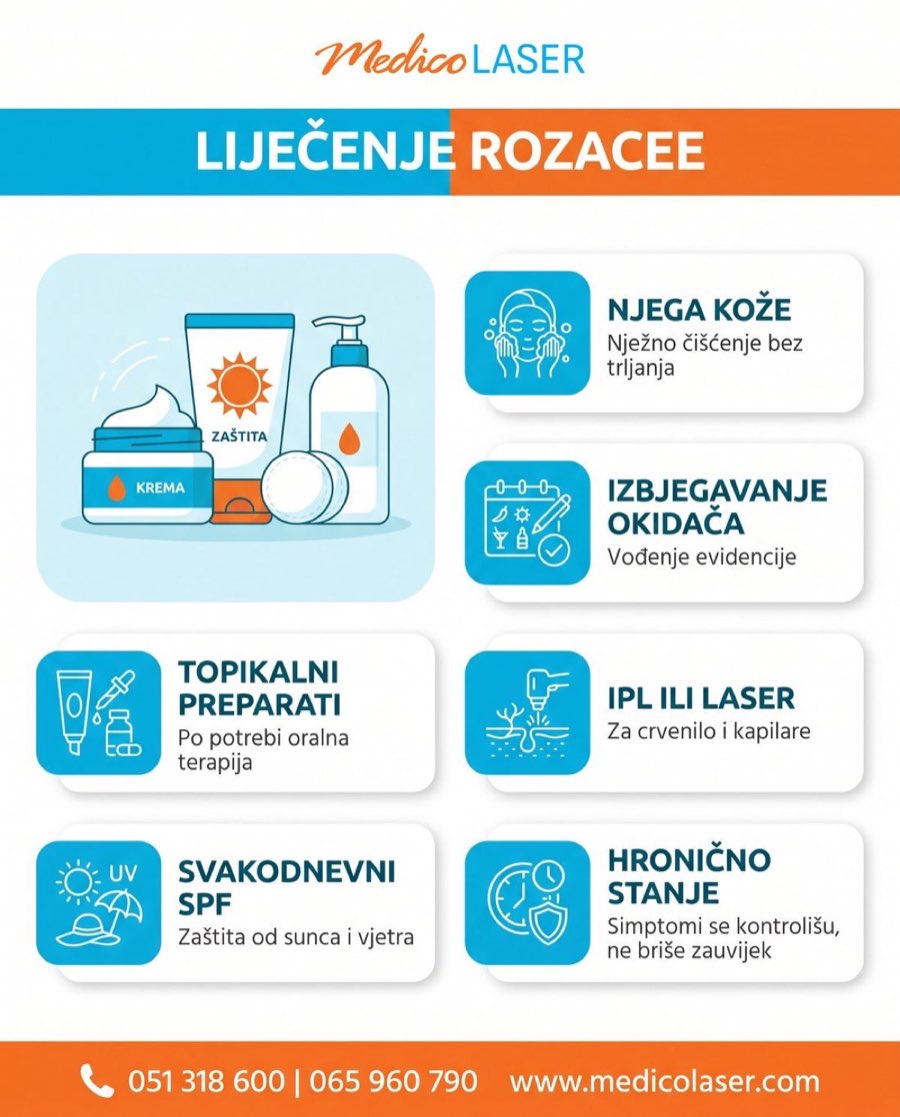 Liječenje rozacee - infografika