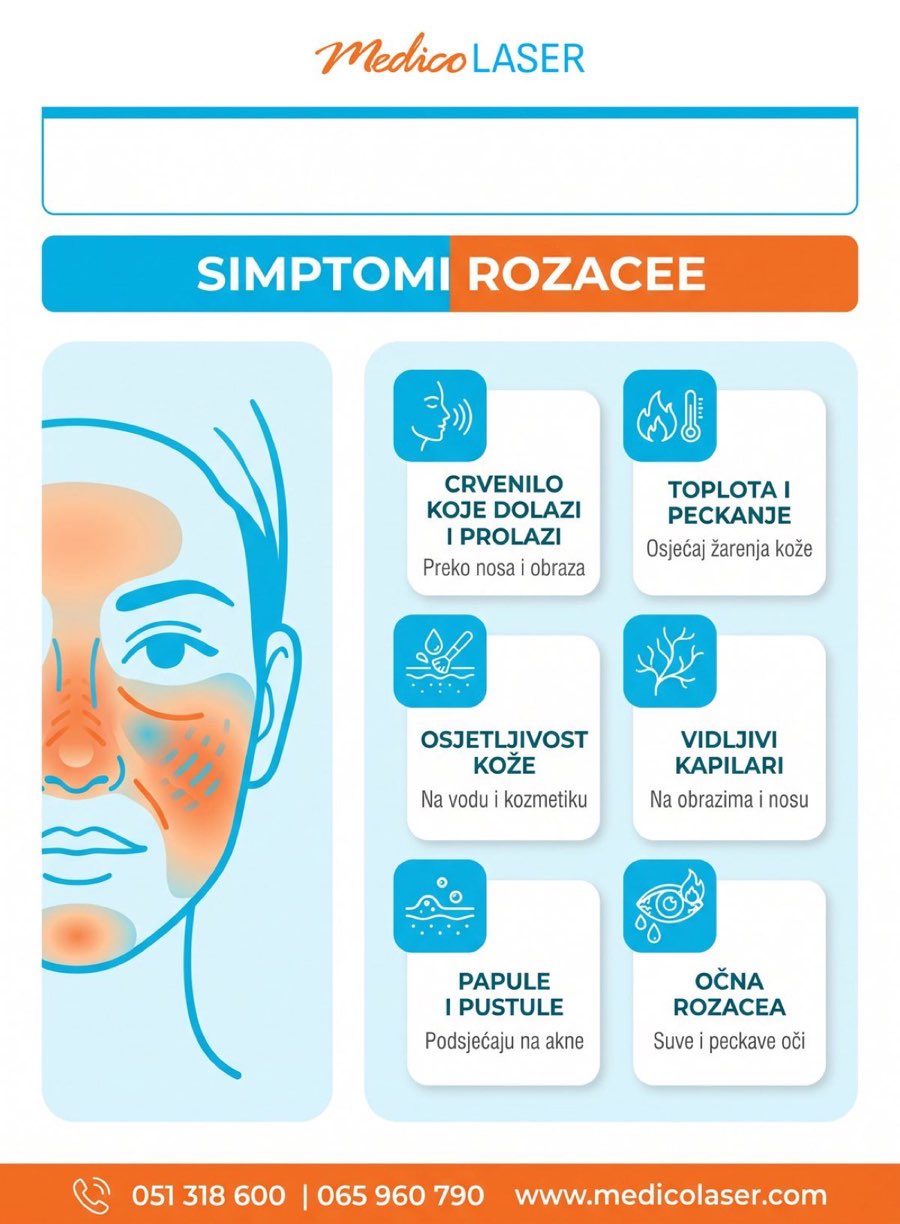 Simptomi rozacee - infografika