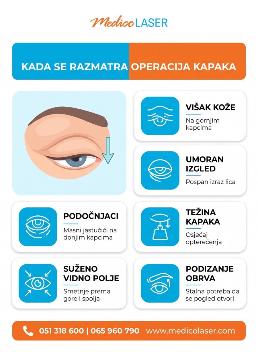 Kada se razmatra operacija kapaka - infografika