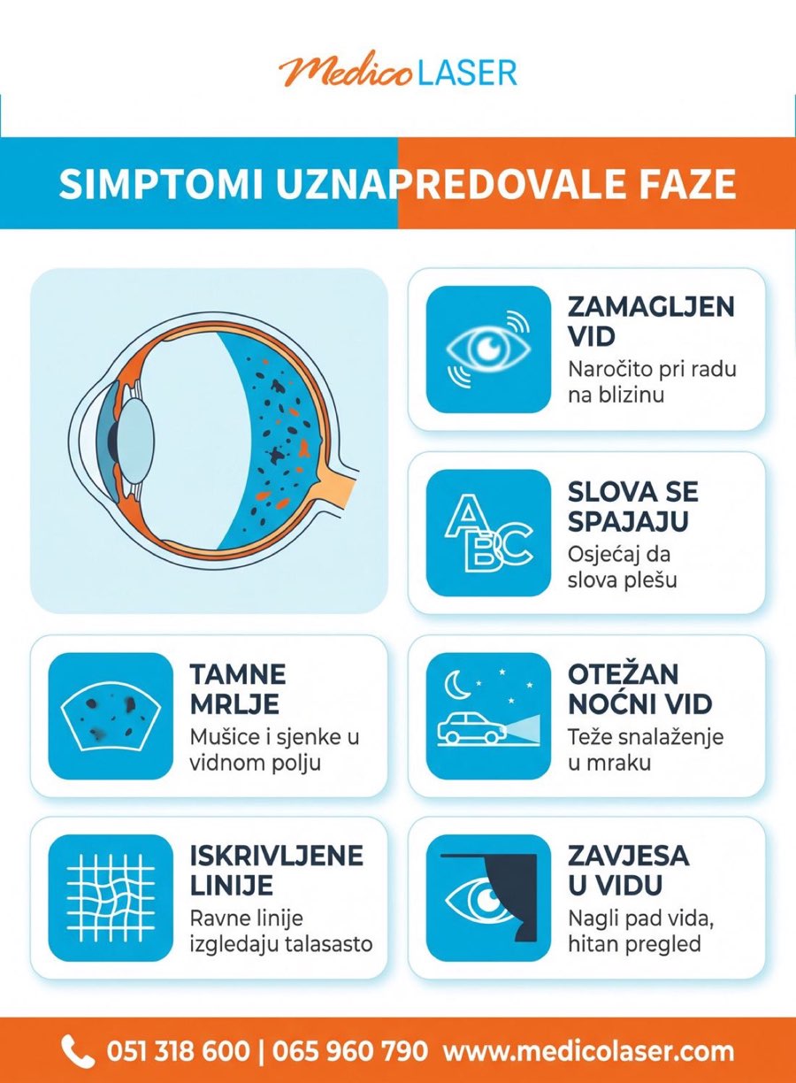 Simptomi uznapredovale dijabetičke retinopatije - zamagljen vid, slova se spajaju, tamne mrlje, otežan noćni vid, iskrivljene linije, zavjesa u vidu