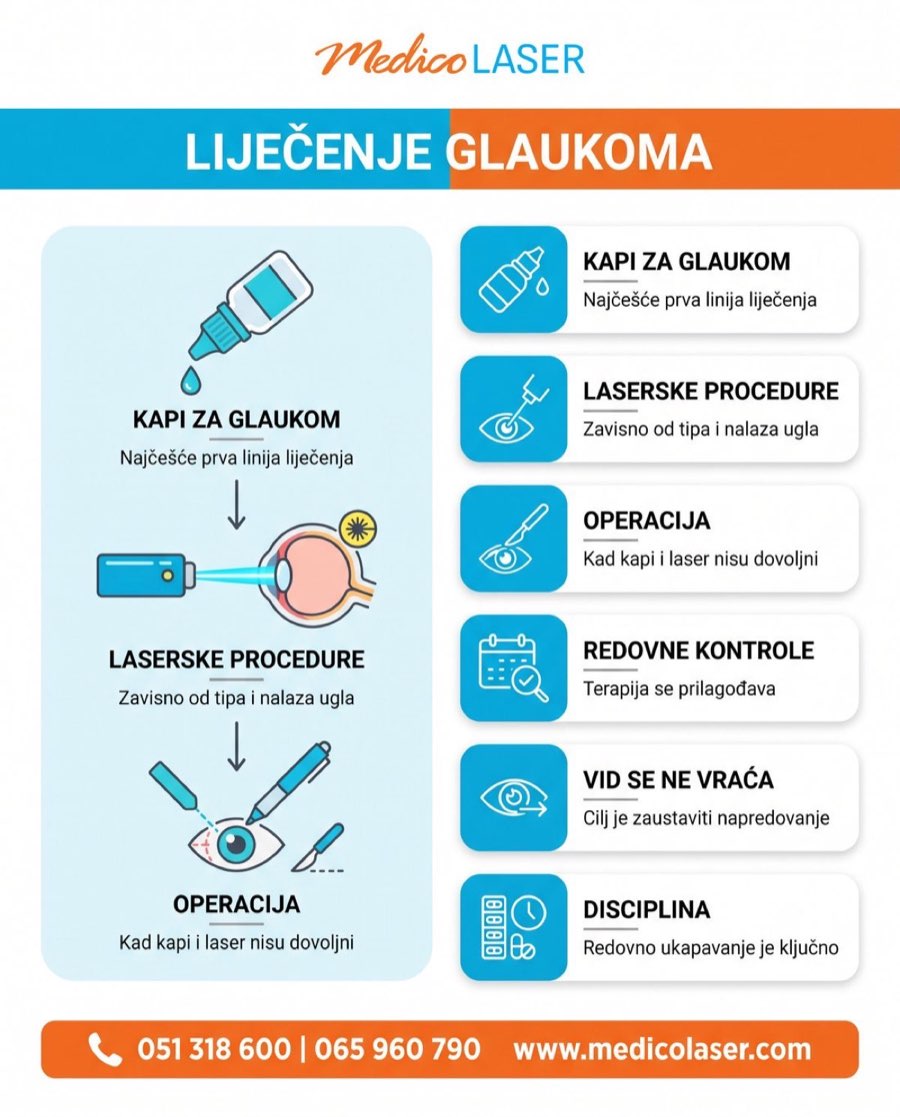 Liječenje glaukoma - kapi, laser, operacija
