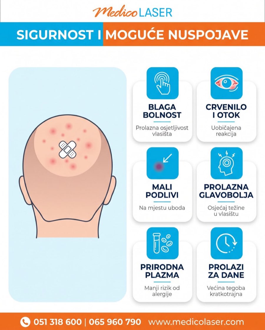 Infografika sigurnost i moguce nuspojave PRP tretmana kose - blaga bolnost, crvenilo, mali podlivi, prolazna glavobolja, prirodna plazma, prolazi za dane