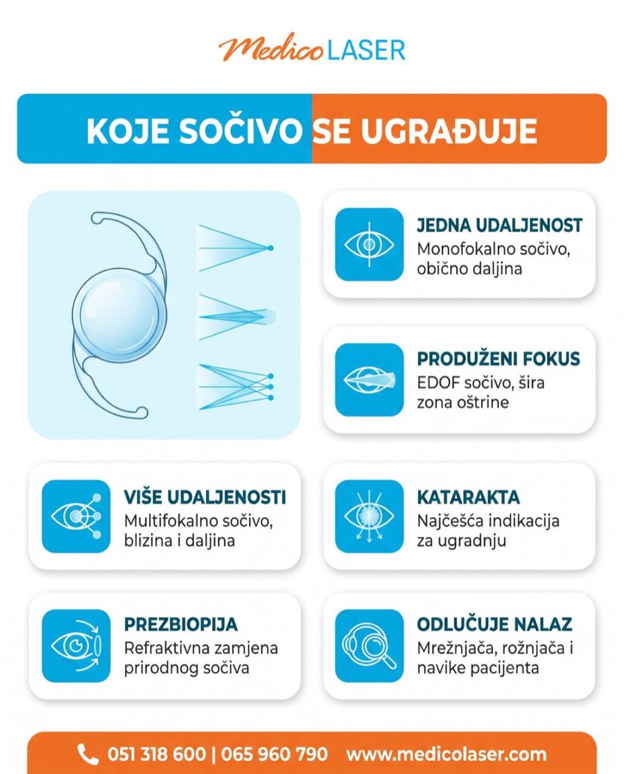 Koje intraokularno sočivo se ugrađuje - infografika