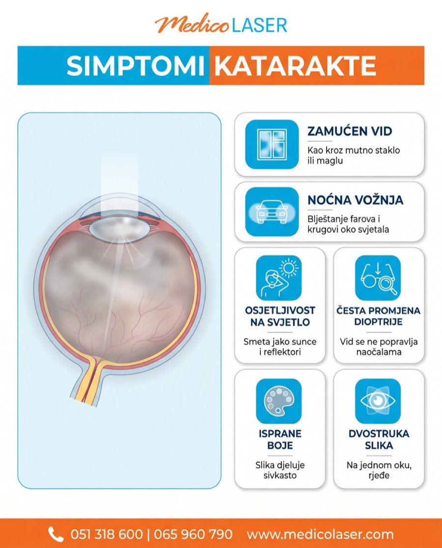 Simptomi katarakte - infografika
