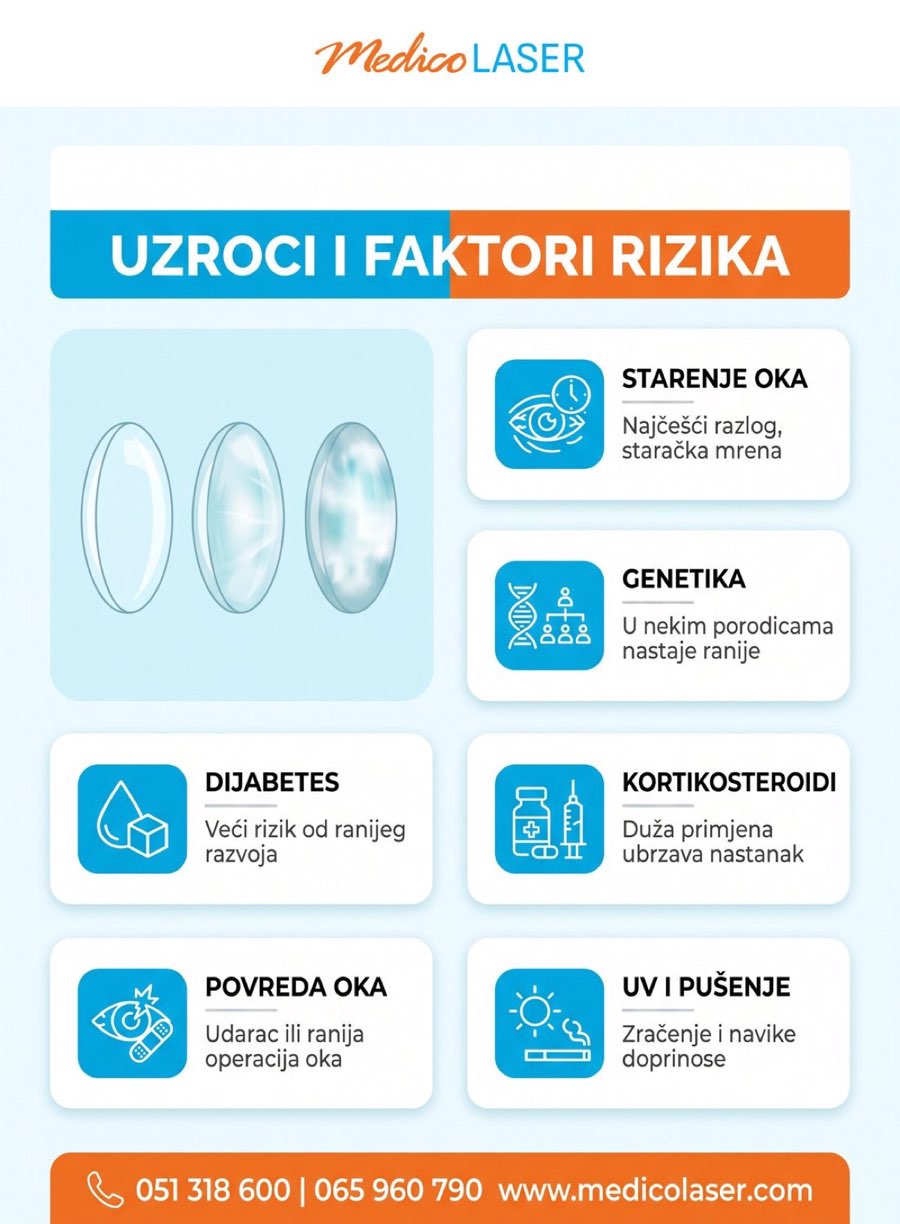 Uzroci i faktori rizika za kataraktu - infografika