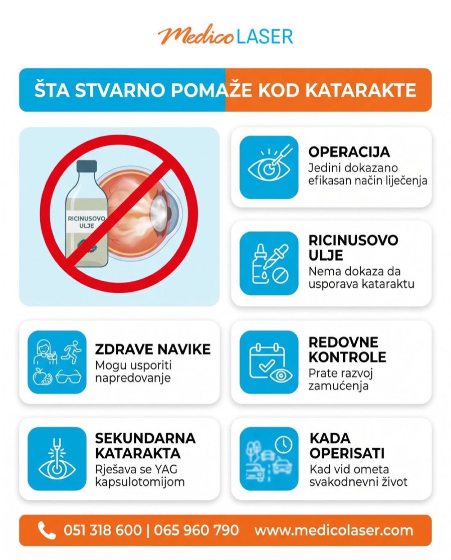 Šta stvarno pomaže kod katarakte - infografika