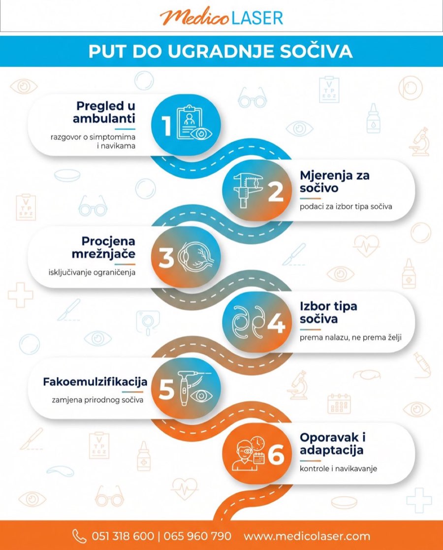 Put do ugradnje sočiva - infografika