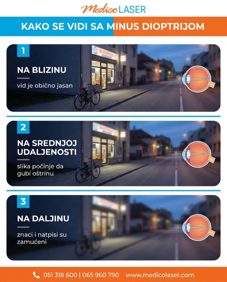 Kako se vidi sa minus dioptrijom - simulacija kratkovidnog vida