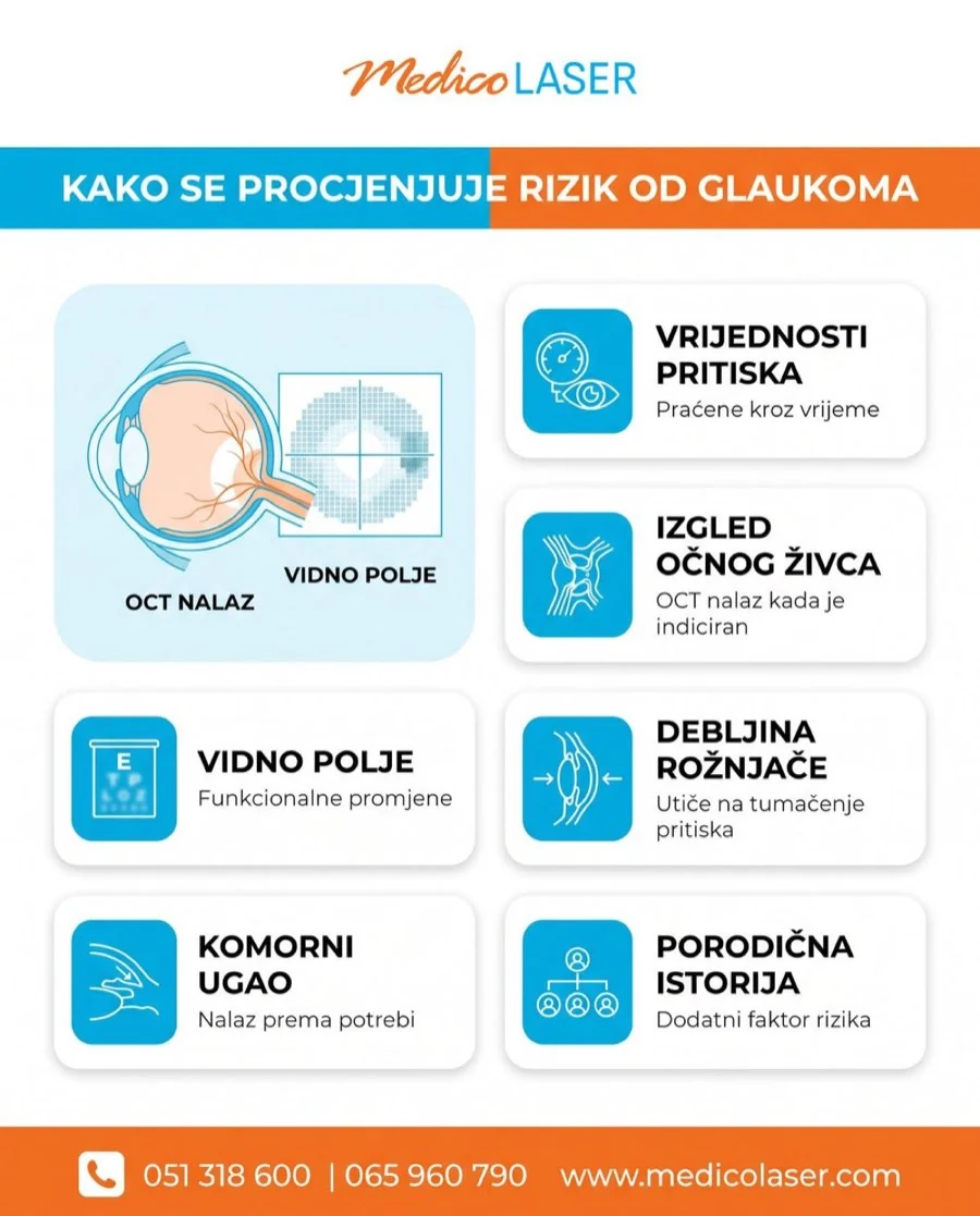 Kako oftalmolog procjenjuje rizik od glaukoma: očni pritisak, očni živac, vidno polje i debljina rožnjače