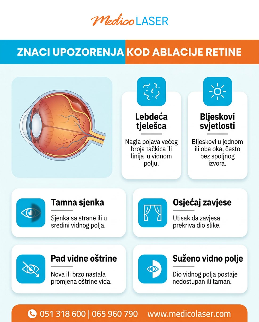 Znaci upozorenja kod ablacije retine: lebdeća tjelešca, bljeskovi, tamna sjenka i zavjesa u vidnom polju