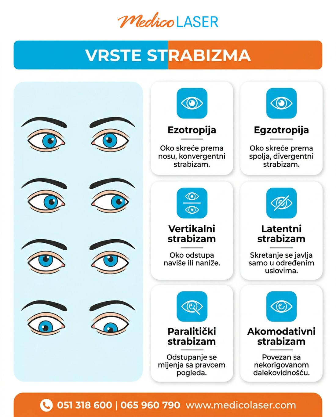 Vrste strabizma: ezotropija, egzotropija, vertikalni, latentni, paralitički i akomodativni strabizam