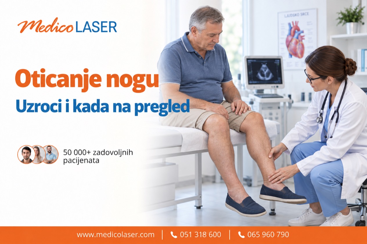 Oticanje nogu - uzroci, crvene zastavice i pregled
