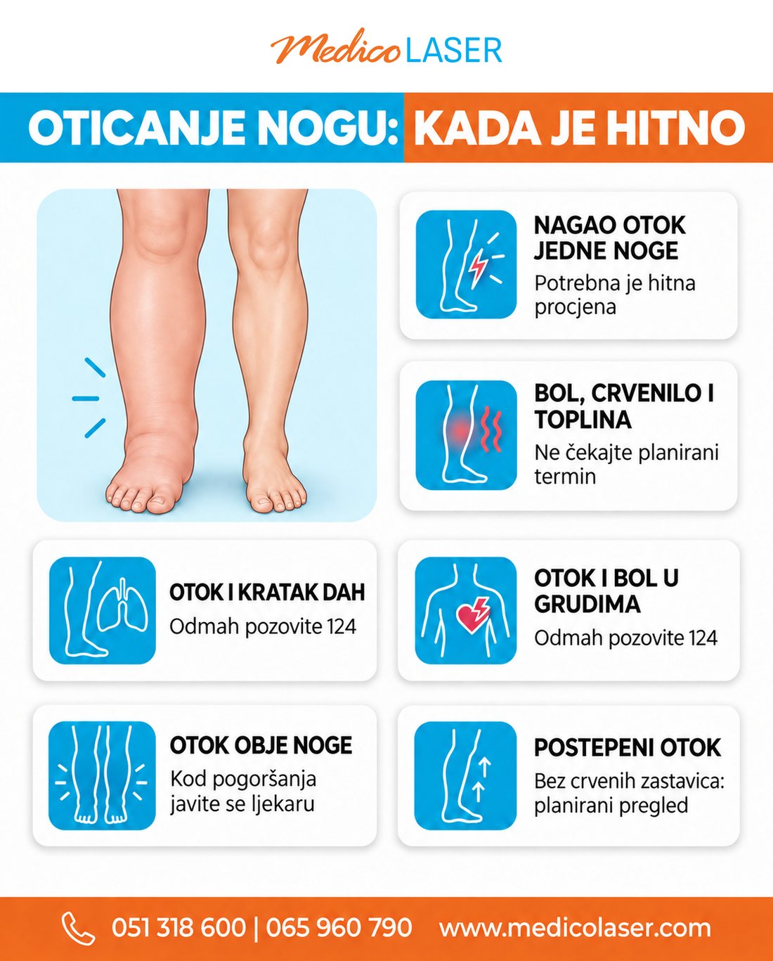 Crvene zastavice uz oticanje nogu koje zahtijevaju hitnu procjenu