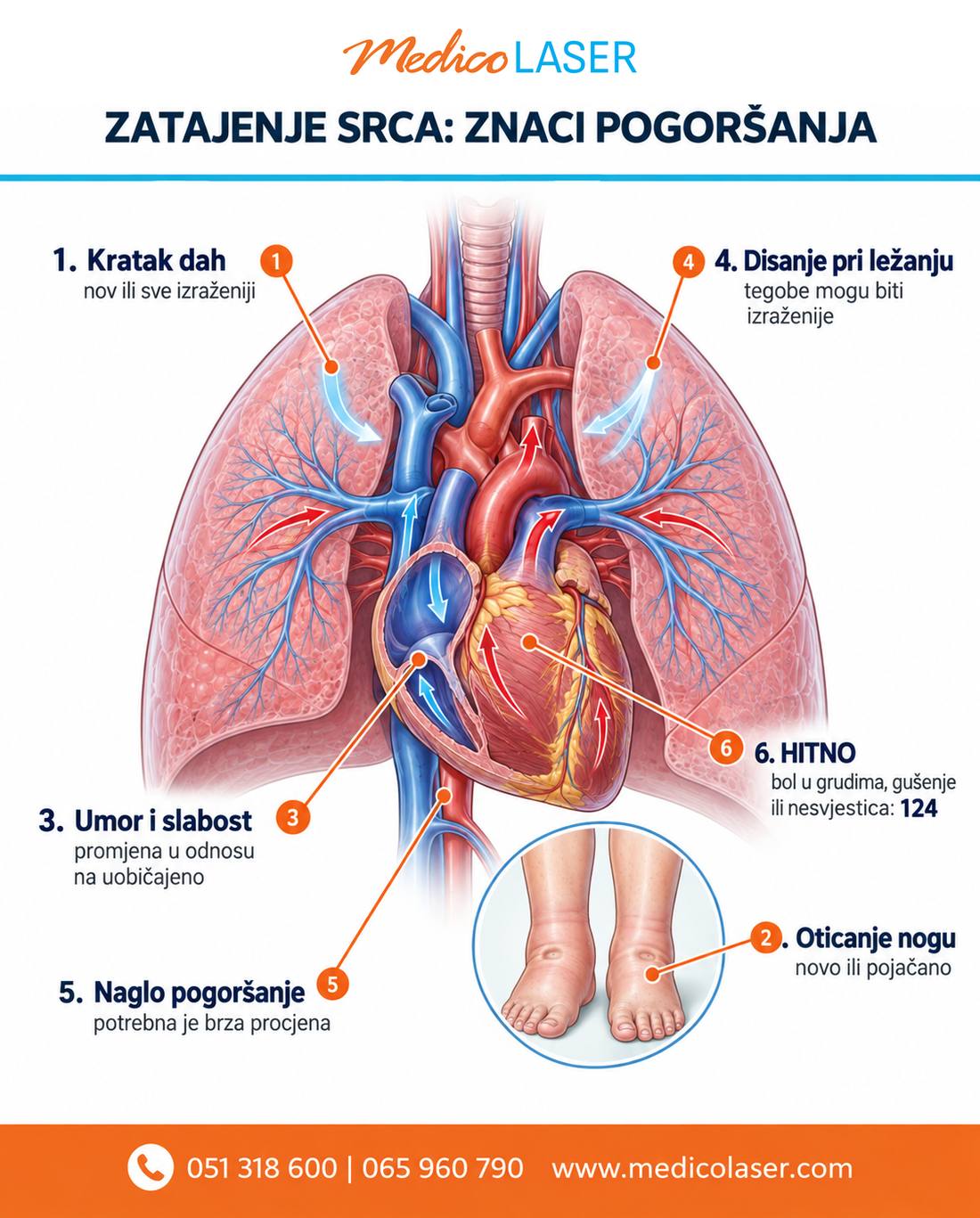 Anatomski prikaz zatajenja srca i znakovi mogućeg pogoršanja