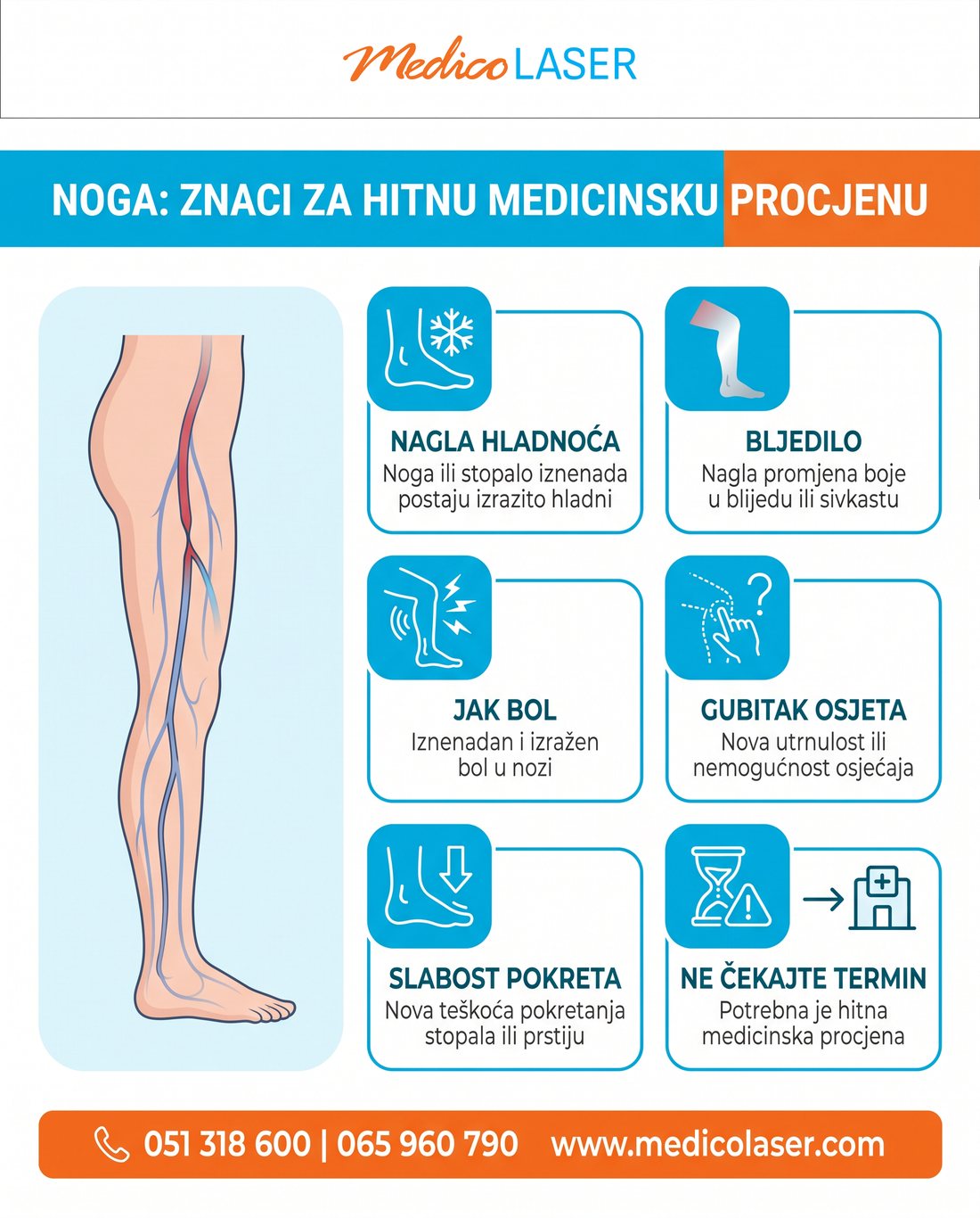 Hitni znaci naglo ugrožene cirkulacije u nozi