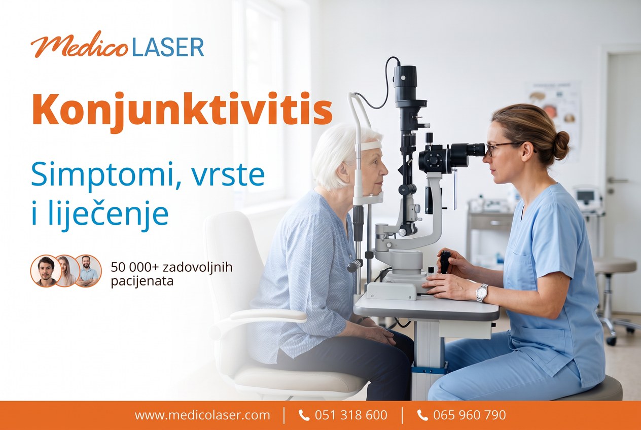 Konjunktivitis i oftalmološki pregled u Medico Laseru Banja Luka
